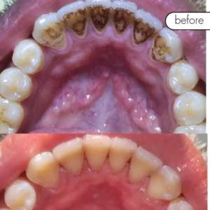 Before and after Scaling