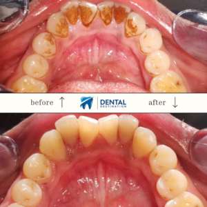 Before and after Scaling 