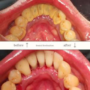 Before and after Scaling