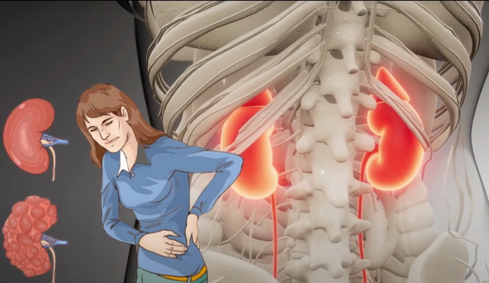 Proteinuria and Hematuria